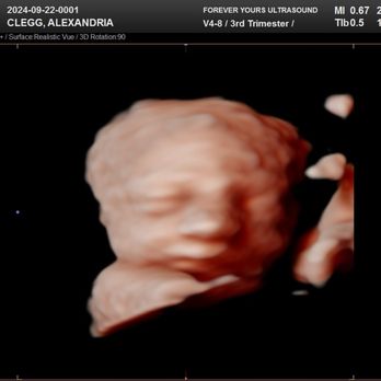 Forever Yours Ultrasound - Ultrasound Imaging Centers Near Me - Fullerton, California