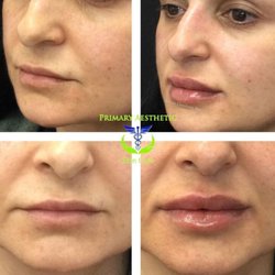 Primary Aesthetic Skin Care