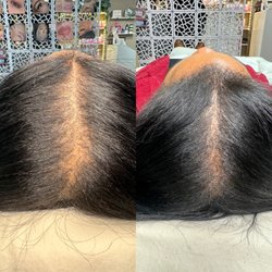 Wynter Willow Beauty - SML Scalp Micropigmentation