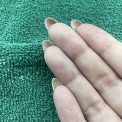 Paradise Tomball Nails & Spa - Holes leading to nail fungus in pinky, ring finger, and peeling back on pointer finger