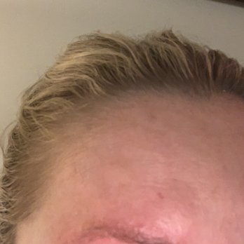 The Aesthetic Studio  - Painful allergic reaction - Eyebrow Services Near Me - Meridian, Idaho