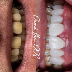Calimesa Dental - David You, DDS - 8 cosmetic units