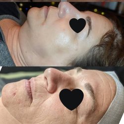 Rejuve Med Spa