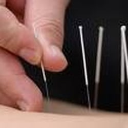 Ye's Acupuncture Clinic