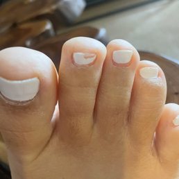 Picture taken a few days after the pedicure
