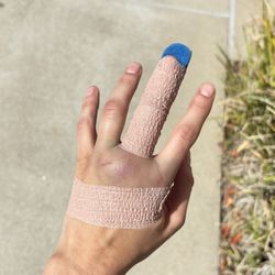 Urgent Care Now - Fair Oaks - Splint and wrap the ER gave me to show severity and emphasize the ridiculous splint the urgent care gave me
