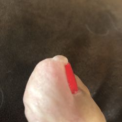 Solar Nails - 7/28/21 - Two days after pedicure - bubble started on top of toe