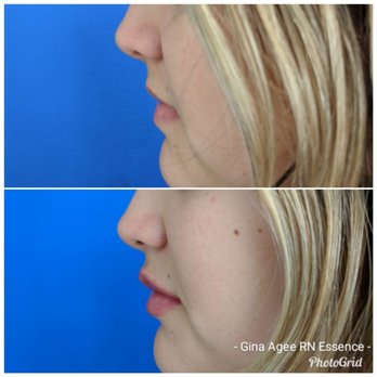 Essence Skin Spa - Medical Spas Near Me - Gilbert, Arizona