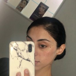 Dermal Infusion Facial results!