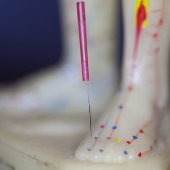 Acupuncture Remedies - Acupuncture Near Me - New York, New York Acupuncture Remedies - Acupuncture Near Me - New York, New York