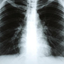 Mercy Medical Center Radiology