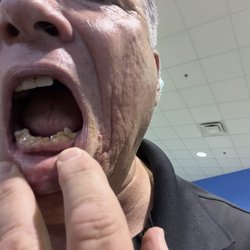 Dental Brothers - That before picture .