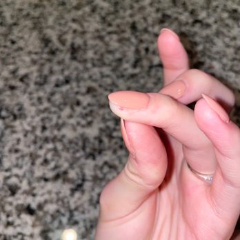 Lush Nail Lounge - This is just 1 out of 4 fingers that were cut like this. - Nail Salons Near Me - Tucson, Arizona Lush Nail Lounge - This is just 1 out of 4 fingers that were cut like this. - Nail Salons Near Me - Tucson, Arizona