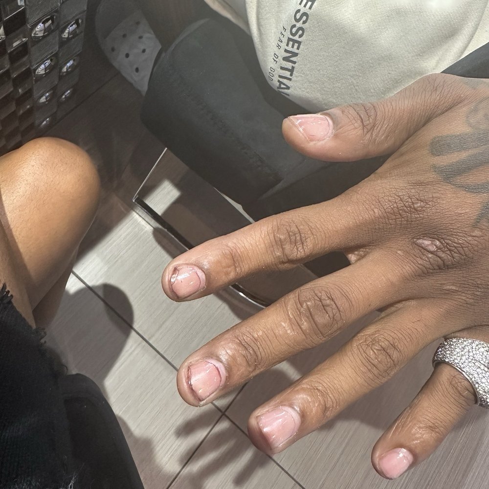 Nail Pub - Damaged nails ! - Nail Salons Near Me - Miami Beach, Florida Nail Pub - Damaged nails ! - Nail Salons Near Me - Miami Beach, Florida