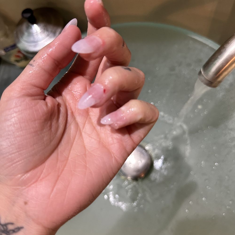 just my bloody tender cuticles
