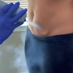 Lotus Health & Wellness Center - Cryotherapy targets stubborn fatty areas