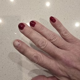 Photo of nail where polish chipped and then peeled off. Photo of nail where polish chipped and then peeled off.