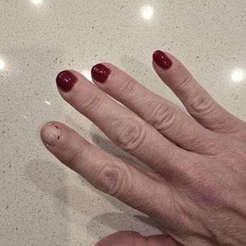 Classic And Fancy Nail Spa - Photo of nail where polish chipped and then peeled off. - Nail Salons Near Me - Goodyear, Arizona