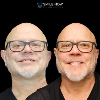 Smile Now Reno Dentures and Implants - Cosmetic Dentists Near Me - Reno, Nevada Smile Now Reno Dentures and Implants - Cosmetic Dentists Near Me - Reno, Nevada