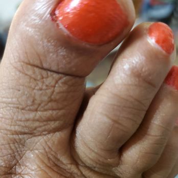 Elevation Beauty and Nail Spa - Bleeding toe. - Nail Salons Near Me - Charlotte, North Carolina Elevation Beauty and Nail Spa - Bleeding toe. - Nail Salons Near Me - Charlotte, North Carolina