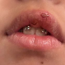 Oral & Maxillofacial Surgery Associates