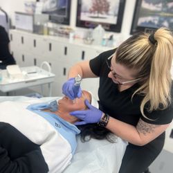 Miss Esthetics - SkinPen Microneedling