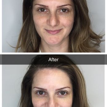 VitaVida Beauty - CryoFacials are amazing for special events, weddings, or simply putting your best face forward - Skin Care Near Me - Highland, Maryland VitaVida Beauty - CryoFacials are amazing for special events, weddings, or simply putting your best face forward - Skin Care Near Me - Highland, Maryland