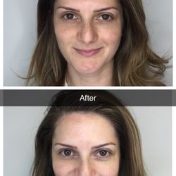 VitaVida Beauty - CryoFacials are amazing for special events, weddings, or simply putting your best face forward