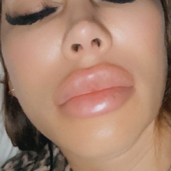 BeautyBossMD - Skin Care Near Me - Newport Beach, California