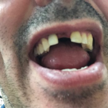 Ace Dental Center - Oral Surgeons Near Me - Lombard, Illinois