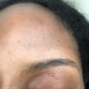 Nail Tiki - Scabs on my eyelid because they can't do eyebrows properly - Nail Salons Near Me - Hyattsville, Maryland Nail Tiki - Scabs on my eyelid because they can't do eyebrows properly - Nail Salons Near Me - Hyattsville, Maryland