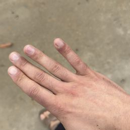 I got my nails done before my vacation. However, the next day my hand got infected, and my vacation was like hell because of it. I got my nails done before my vacation. However, the next day my hand got infected, and my vacation was like hell because of it.