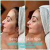 Serenity Skin Spa gift card