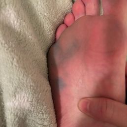 Blue tablet in the pedicure tub dyed the bottom of my foot. I didn't notice until I got home. Blue tablet in the pedicure tub dyed the bottom of my foot. I didn't notice until I got home.