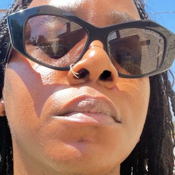 Balanced Body Spa - Before my 2nd HydraFacial Platinum With INDIBA® And LED Therapy. - Skin Care Near Me - Los Angeles, California Balanced Body Spa - Before my 2nd HydraFacial Platinum With INDIBA® And LED Therapy. - Skin Care Near Me - Los Angeles, California