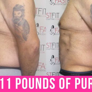 Fast Fit Body Sculpting - Fast Fit Body Sculpting Fat Weight Loss Review Before and After Skin Tightening - Weight Loss Centers Near Me - Pooler, Georgia Fast Fit Body Sculpting - Fast Fit Body Sculpting Fat Weight Loss Review Before and After Skin Tightening - Weight Loss Centers Near Me - Pooler, Georgia