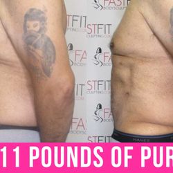 Fast Fit Body Sculpting - Fast Fit Body Sculpting Fat Weight Loss Review Before and After Skin Tightening