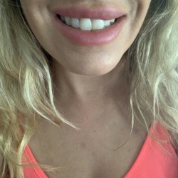 La Chelé Medical Aesthetics and Wellness - Horrible botched job!!! Still isn't right a year later. Beware. These people are unqualified and do not care when they make a mistake.
