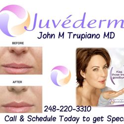 John M Trupiano, MD, FACS - Natural Full Youthful #Lips, get your #pout back. Request a appointment at: http://drtrupiano.com/contact-us/ Call Office 248-220-3310