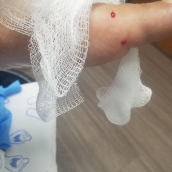 Austin Foot & Ankle Center - Ingrown toenail (after anesthesia) - Podiatrists Near Me - Austin, Texas Austin Foot & Ankle Center - Ingrown toenail (after anesthesia) - Podiatrists Near Me - Austin, Texas