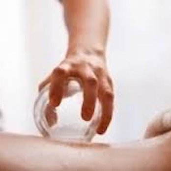 Integrated Therapies - Cupping - Massage Near Me - Edmonton, Alberta Integrated Therapies - Cupping - Massage Near Me - Edmonton, Alberta