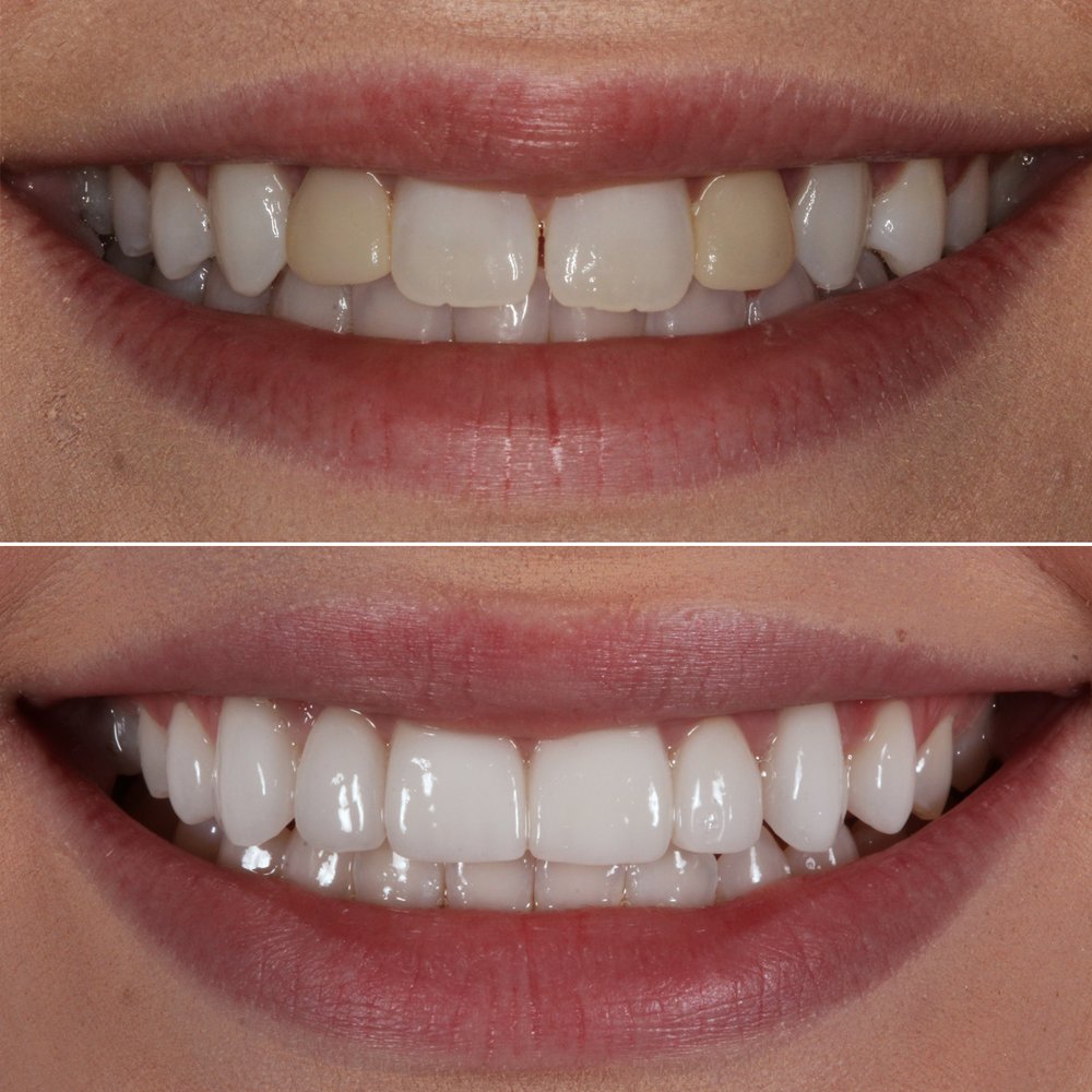 CRANBERRY DENTAL STUDIO 52 Photos & 16 Reviews 10011 Pendleton Way