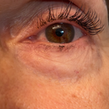 Eye Makeovers - After - Permanent Makeup Near Me - Redondo Beach, California Eye Makeovers - After - Permanent Makeup Near Me - Redondo Beach, California