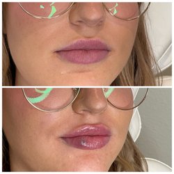 Essence Skin Spa