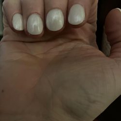Deluxe Foot Spa - Clubbed looking fingernails