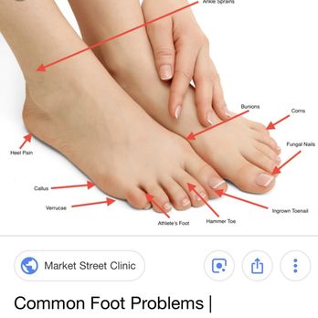 Sweet Wm E DPM - Common foot problems... - Podiatrists Near Me - Palm Springs, California Sweet Wm E DPM - Common foot problems... - Podiatrists Near Me - Palm Springs, California