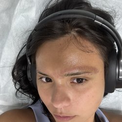 Nucell Skin Medspa - Swelling of eyebrow
