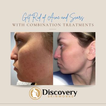 Discovery Skinworks - Medical Spas Near Me - Valencia, California Discovery Skinworks - Medical Spas Near Me - Valencia, California