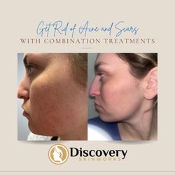 Discovery Skinworks