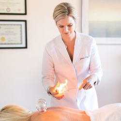 Dr Juliana King, DACM - Fire cupping therapy